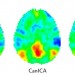 Image of Machine learning for neuroimaging with scikit-learn